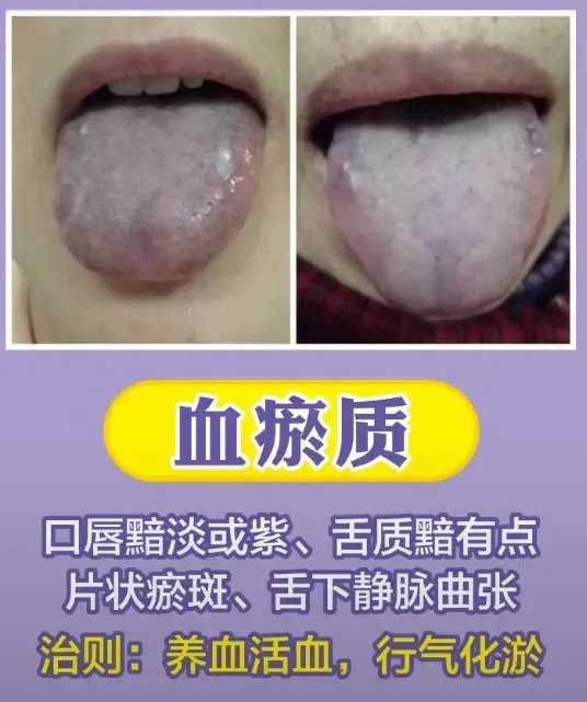 《中医舌诊》最常见九大体质舌诊图(图3)