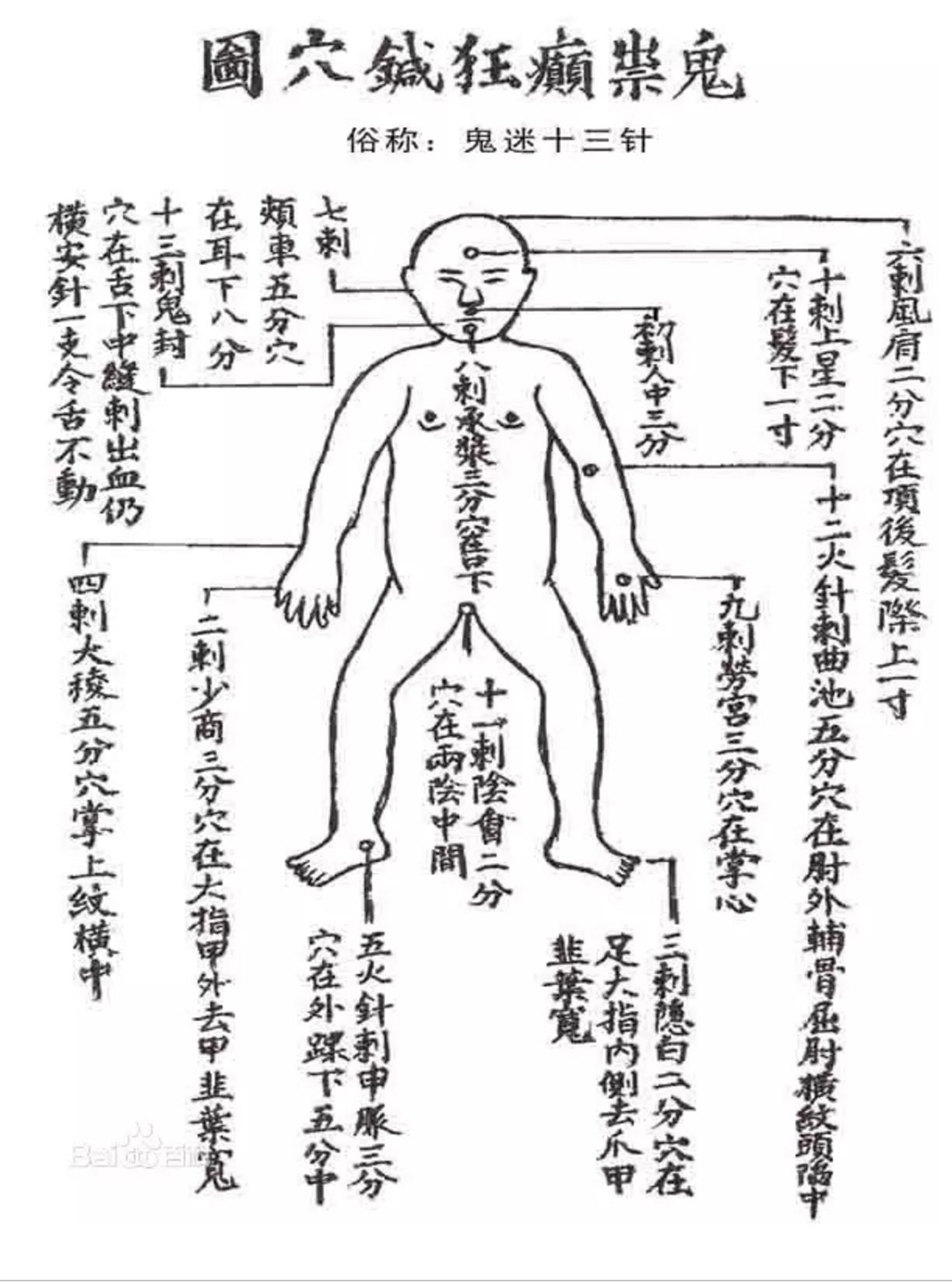 倪海厦讲鬼门十三针案例