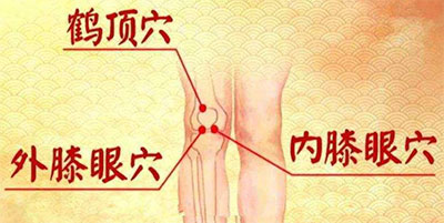 鹤顶