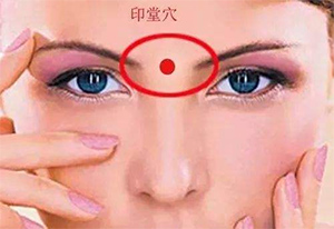印堂穴
