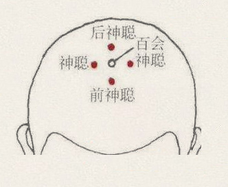 四神聪穴(图1)