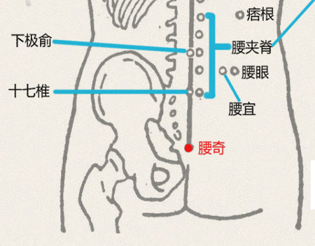 腰奇穴