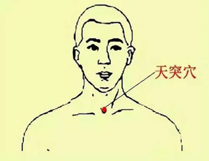 天突穴(图1)