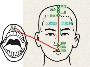 兑端穴