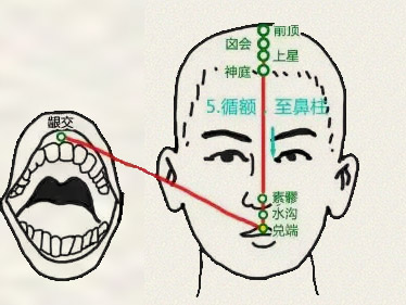 素髎穴