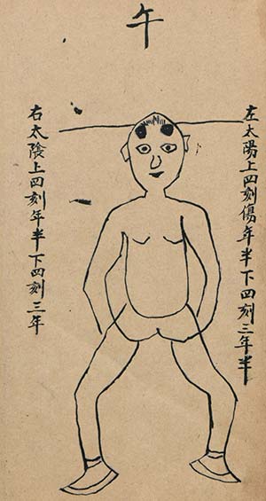 十二時辰穴傷诊治