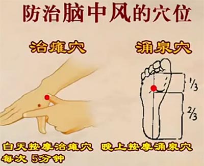 治疗脑中风、脑梗的穴位食疗和中药方