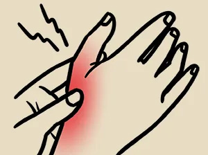 经方治腱鞘炎（腱鞘囊肿）医案和偏方