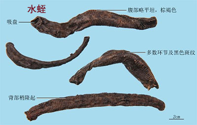 老中医经方治疗肝血管瘤医案和秘方