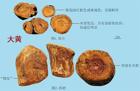 中医治急性结膜（红眼病、炎天行赤眼）验方偏方(图2)
