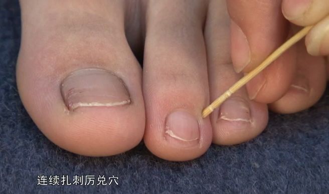 中医治胡言乱语（说胡话）、梦魇、梦游、鬼压床医案附道家方法(图3)